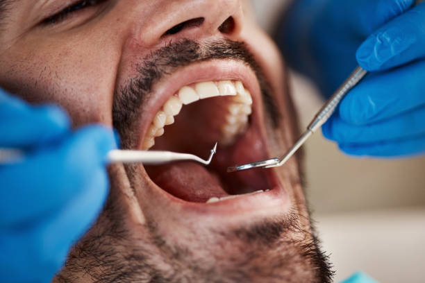 Best Emergency Dental Services for Seniors in Pahokee, FL