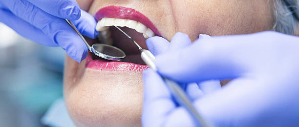 Best Emergency Dentist for Knocked-Out Tooth in Pahokee, FL